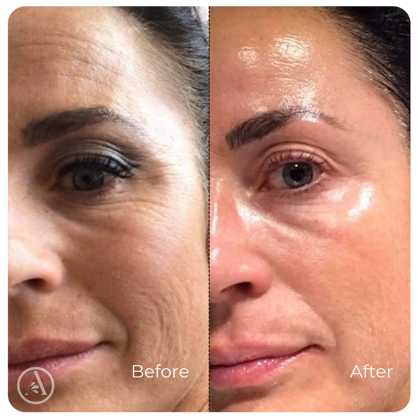 Sephorin™ Peptide Lifting Ampoule