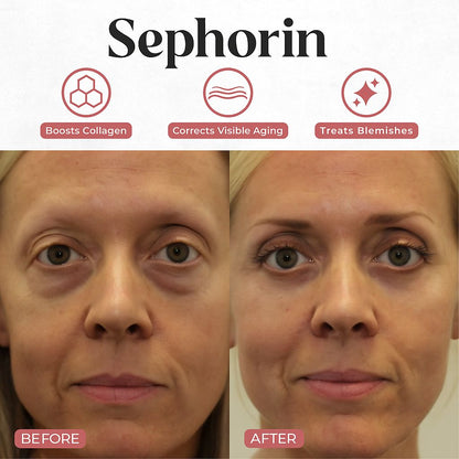 Sephorin™ GlowTouch Eye Cream & Massager – Powered by YCZ Technology