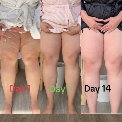 Sephorin™ Cryo Sculpting Gel